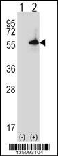 Mouse Sgk3 Antibody