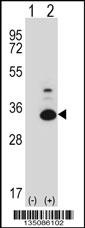 Mouse Tp53rk Antibody