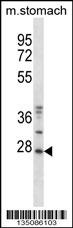 Mouse Tp53rk Antibody