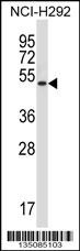 Mok Antibody