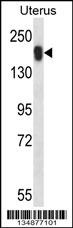 USP43 Antibody