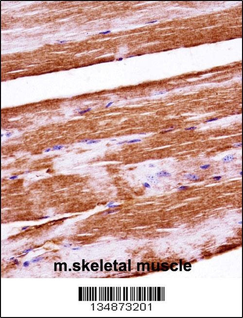Raf1 Antibody