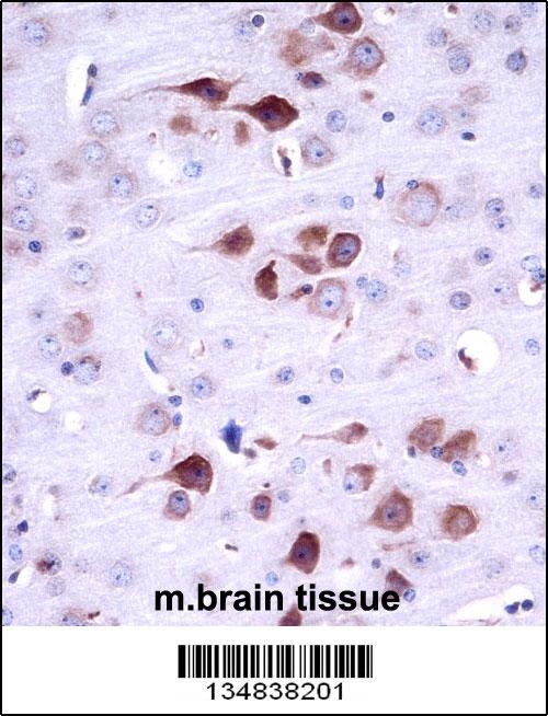 Mouse Matk Antibody