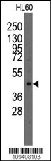 Lmx1a Antibody