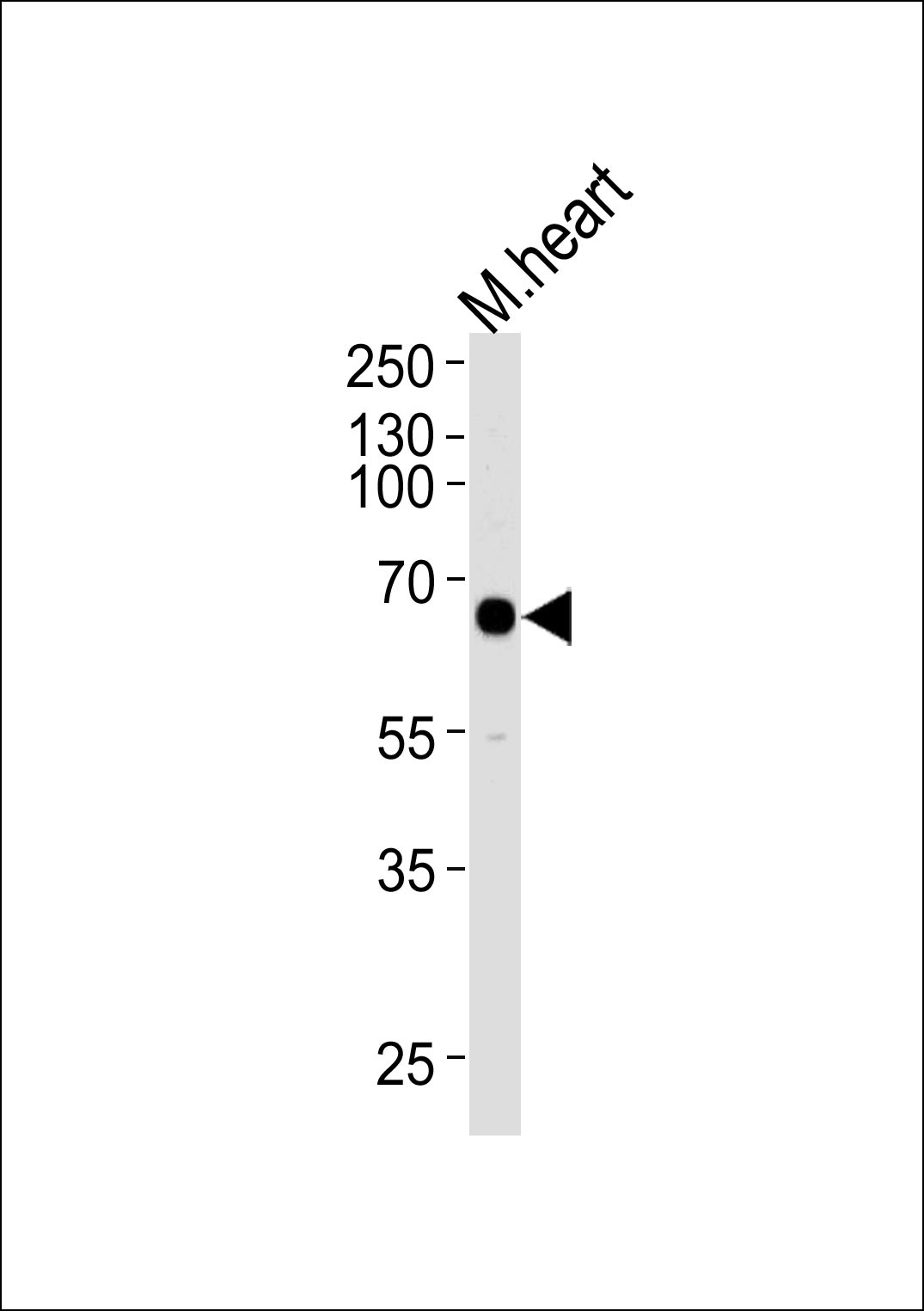 Mouse Mapkapk3 Antibody
