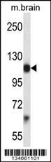 Mouse Pdgfra Antibody