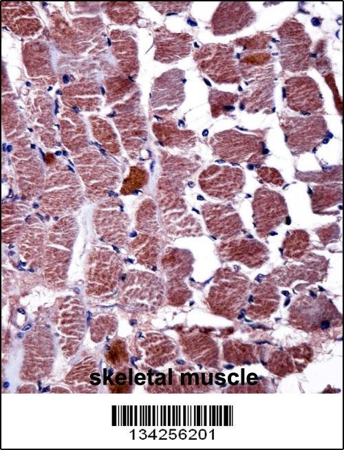 RGS9 Antibody