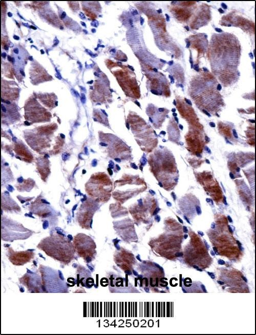 DPYSL3 Antibody