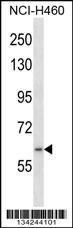 RNF19A Antibody