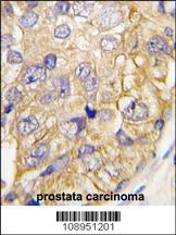 DRAGON Antibody