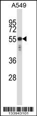 KRT6C Antibody