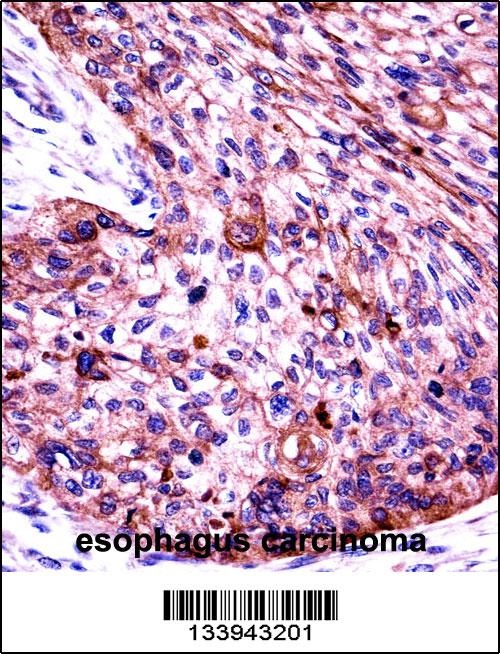 KRT6C Antibody