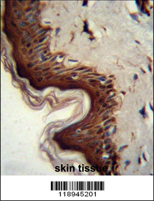 PPL Antibody