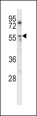 LPL Antibody