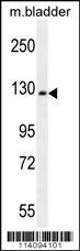 CHRD Antibody