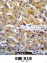 CHRD Antibody