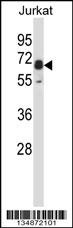 Mouse Pxk Antibody