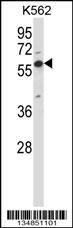 Mouse Oxsr1 Antibody