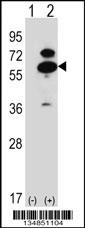 Mouse Oxsr1 Antibody