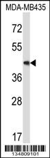 Map2k5 Antibody