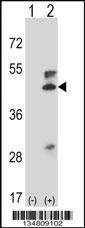 Mouse Map2k5 Antibody