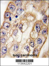CD8A Antibody