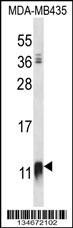 NDUFAB1 Antibody