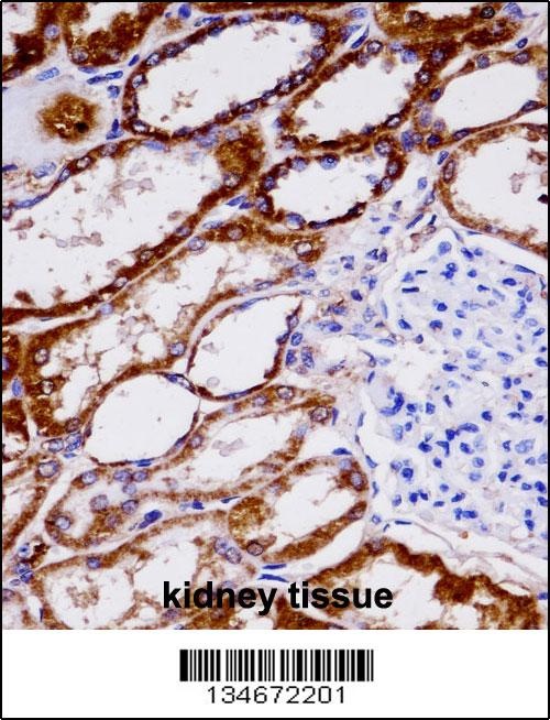 NDUFAB1 Antibody