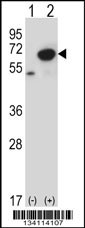 PNKP Antibody