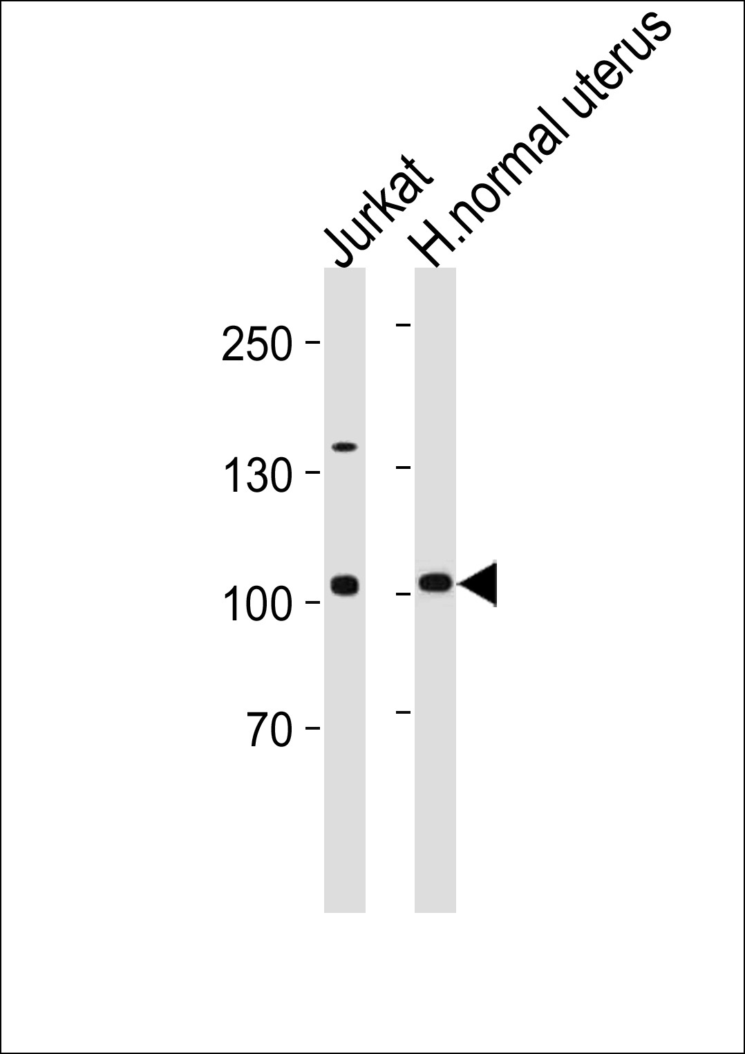 TERT Antibody