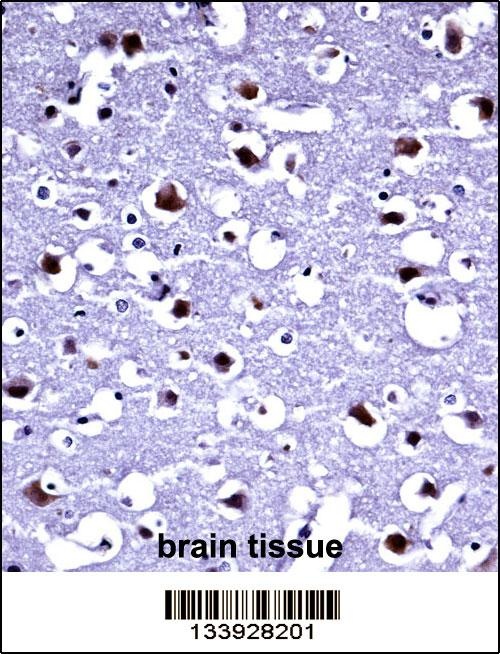 TARBP2 Antibody
