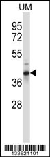 OAF Antibody