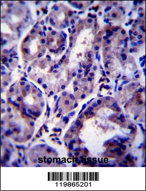 SNX24 Antibody