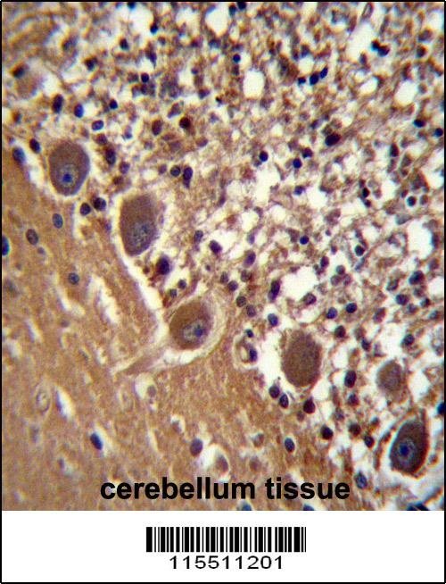 FARSB Antibody