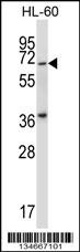 Mouse Pkmyt1 Antibody