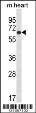 Mouse Pkmyt1 Antibody