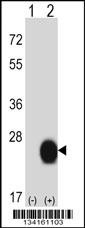 CSRP2 Antibody