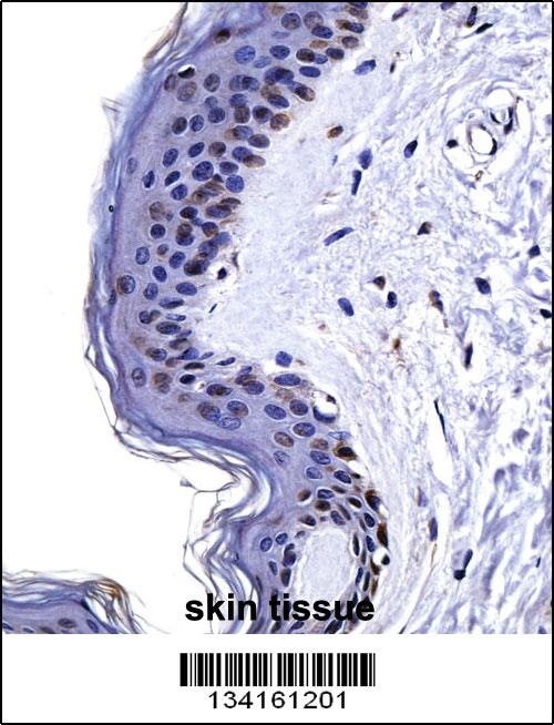 CSRP2 Antibody