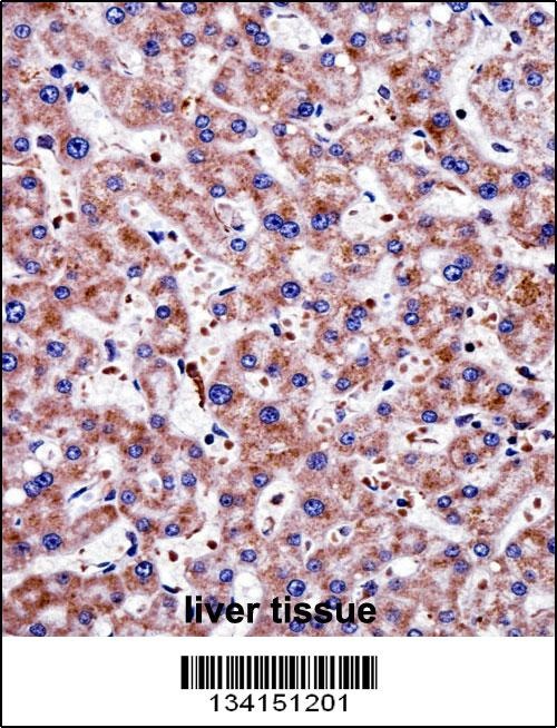 TAGLN2 Antibody