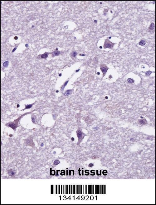 SEC22B Antibody