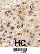 Nucleostemin Antibody