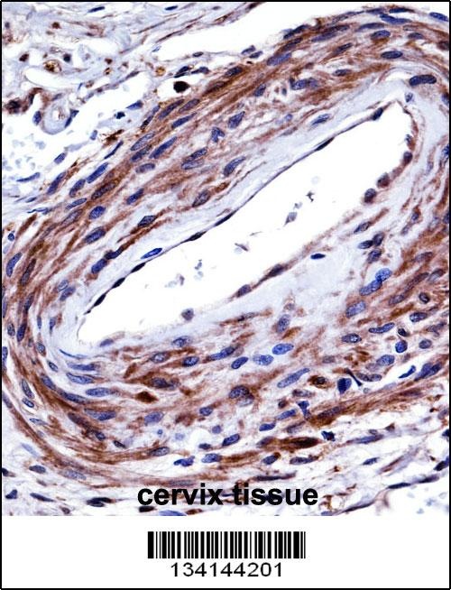 P2RX5 Antibody