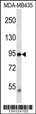 TRPV2 Antibody