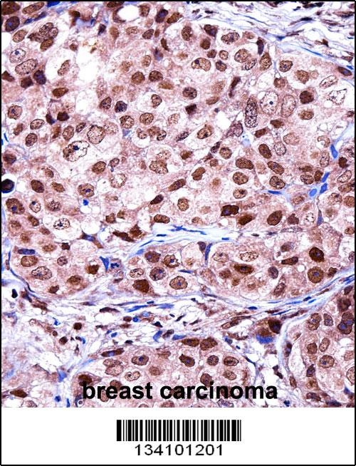 TERF2IP Antibody