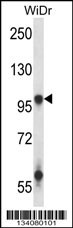 GRIA3 Antibody