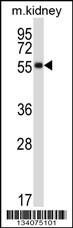 SSTR1 Antibody