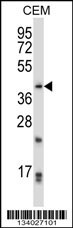 PITX2 Antibody