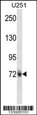 HNRNPM Antibody