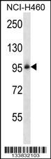 ITGB5 Antibody