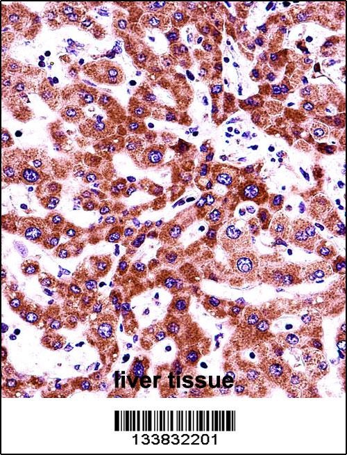 ITGB5 Antibody